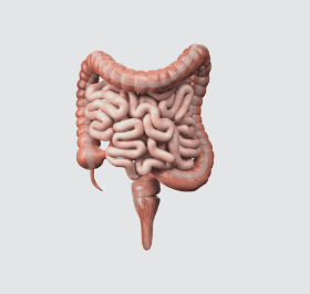 Câncer de colorretal