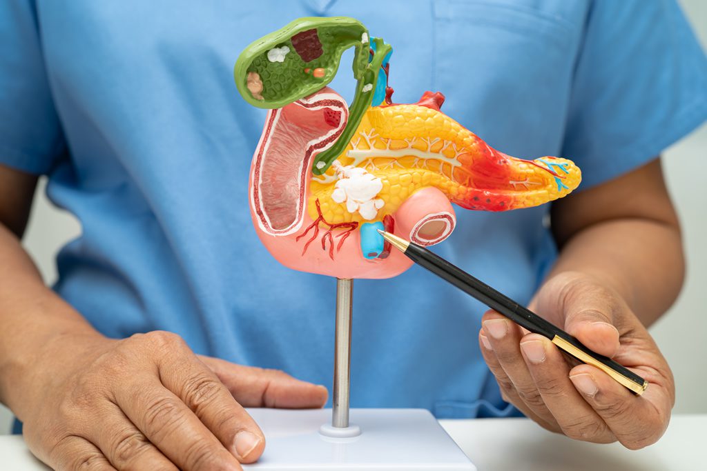 Tumores Neuroendócrinos Pancreáticos