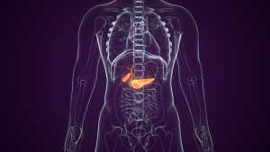 câncer de pâncreas