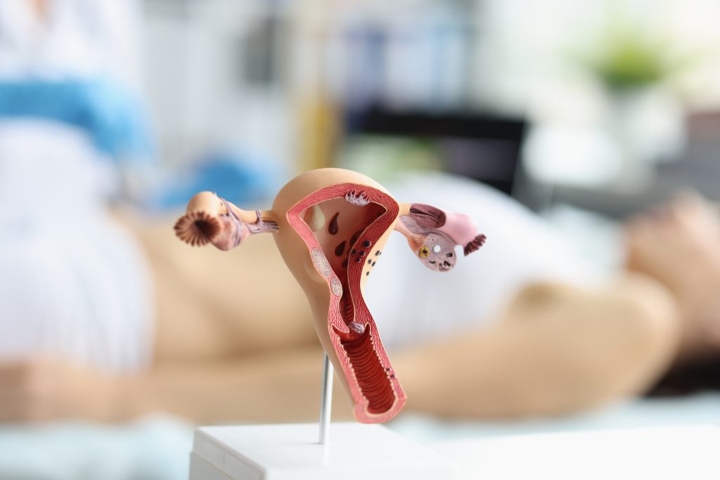 Câncer de Colo do Útero: Causas, HPV e Como Prevenir