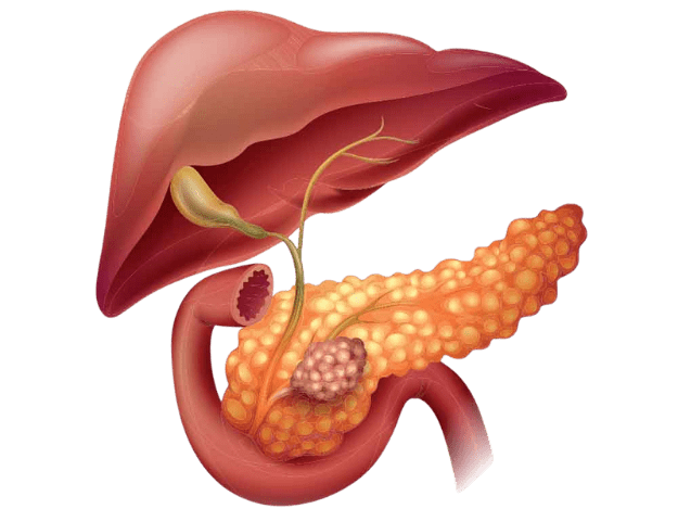 Tratamento de tratamento câncer de pâncreas em Brasília