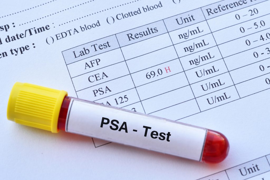 Exame de PSA