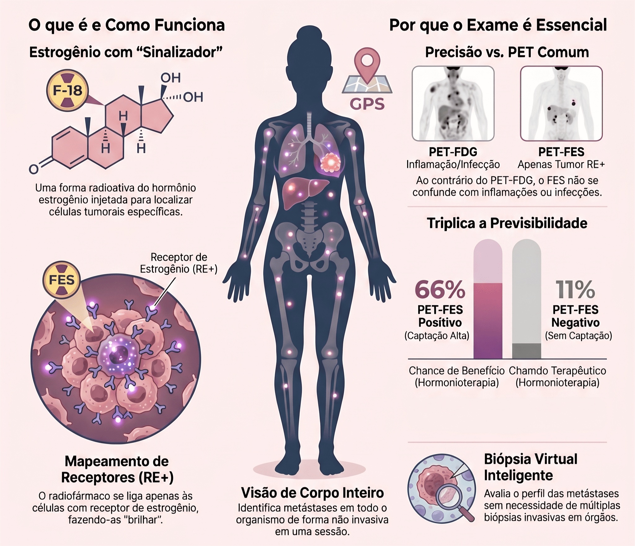 Infográfico sobre o PET-FES, exame que usa estrogênio radioativo para identificar metástases RE+ com alta especificidade, orientando a indicação de hormonioterapia.