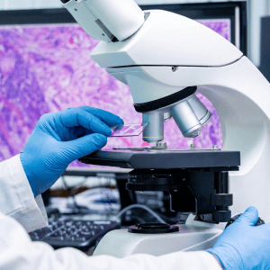 Carcinoma neuroendócrino de grandes células do pulmão