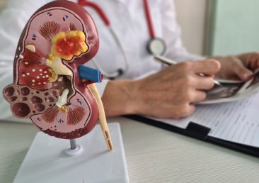 Urology and treatment of kidney diseases. Doctor analyzes patient kidney health with kidney ultrasound and anatomical model