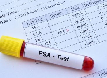 Exame de PSA