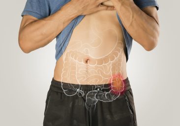 Constipation is a common digestive issue that can cause significant pain in the lower left abdomen, potentially indicating a more serious condition like diverticulitis.