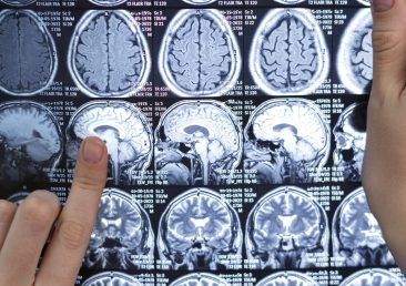 doctor-looking-ct-scan