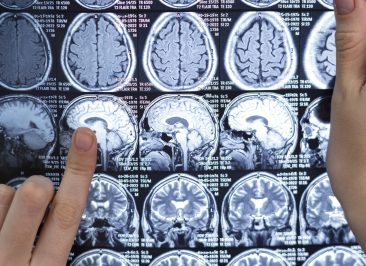 doctor-looking-ct-scan
