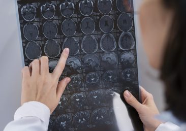 doctor-looking-ct-scan
