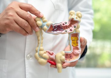 Intestine, appendix and digestive system, doctor holding anatomy model for study diagnosis and treatment in hospital.
