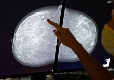 Illustration shows a mammography at the breast clinic of Saint-Jean Clinique - Sint-Jan Kliniek in Brussels, during the fight against the Covid-19 pandemic, Friday 16 October 2020. BELGA PHOTO BENOIT DOPPAGNE (Photo by BENOIT DOPPAGNE/BELGA MAG/AFP via Getty Images)
