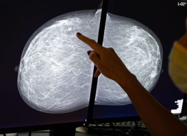 Illustration shows a mammography at the breast clinic of Saint-Jean Clinique - Sint-Jan Kliniek in Brussels, during the fight against the Covid-19 pandemic, Friday 16 October 2020. BELGA PHOTO BENOIT DOPPAGNE (Photo by BENOIT DOPPAGNE/BELGA MAG/AFP via Getty Images)