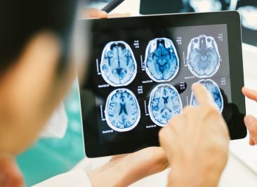 Metástase Cerebral: Sintomas, Diagnóstico e Tratamentos