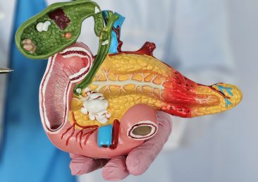 Cirurgia de Whipple no câncer de pâncreas