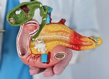 Cirurgia de Whipple no câncer de pâncreas