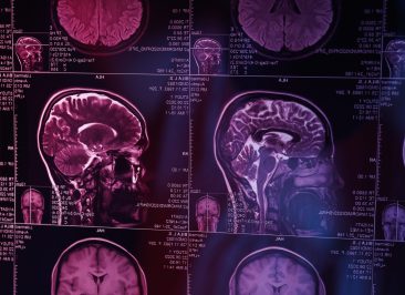 MRI or magnetic resonance imaging of the head and brain. Close up