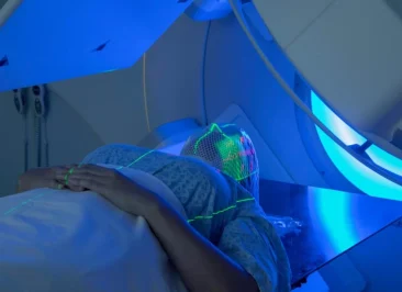 radioterapia tumor cerebral glioblastoma IMRT sessões tratamento