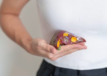 Woman holding human Liver anatomy model. Liver cancer and Tumor, Jaundice, Viral Hepatitis A, B, C, D, E, Cirrhosis, Failure, Enlarged, Hepatic Encephalopathy, Ascites Fluid in Belly and health