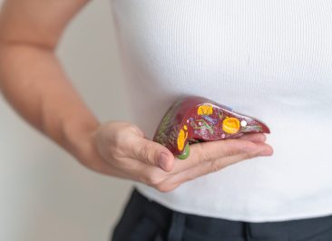 Woman holding human Liver anatomy model. Liver cancer and Tumor, Jaundice, Viral Hepatitis A, B, C, D, E, Cirrhosis, Failure, Enlarged, Hepatic Encephalopathy, Ascites Fluid in Belly and health
